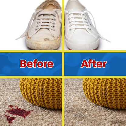 Stingray Spot Remover Combo Kit | Advanced, Eco-Friendly Multi Surface Stain Removal | Includes 32 Fl oz and 4 Fl oz