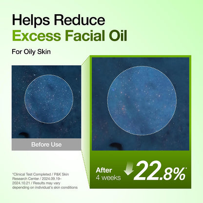 Anua Azelaic Acid 10 Hyaluron Redness Soothing Serum, Facial Serum for Blemish-Prone & Oily-Prone Skin, Lightweight & Hydrating Blemish Care, Hyaluronic Acid, Korean Skincare, 1.01 fl oz.