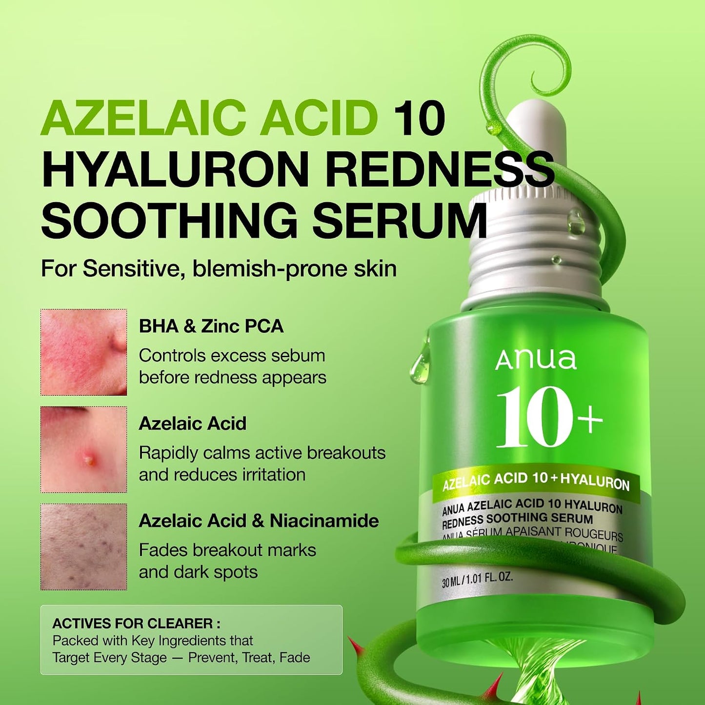Anua Azelaic Acid 10 Hyaluron Redness Soothing Serum, Facial Serum for Blemish-Prone & Oily-Prone Skin, Lightweight & Hydrating Blemish Care, Hyaluronic Acid, Korean Skincare, 1.01 fl oz.