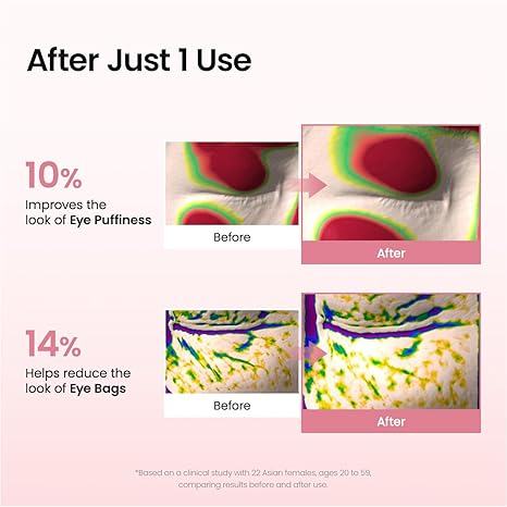 After just 1 use - 10% improves eye puffiness, 14% reduces eye bags