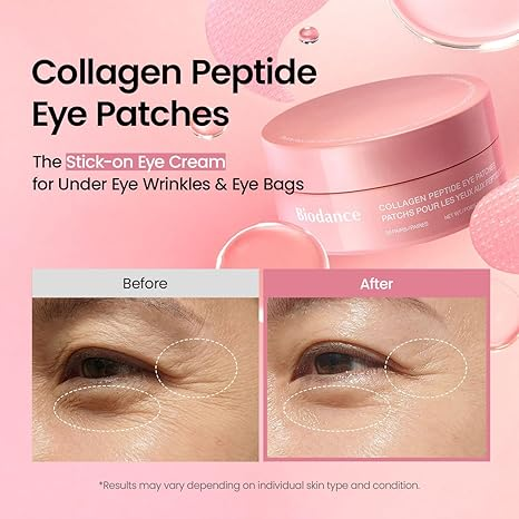 Collagen Peptide Eye Patches - before and after under eye wrinkles